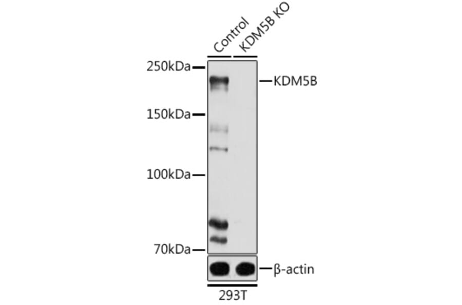 Western Blot - Anti-KDM5B/PLU1/Jarid1B Antibody (A10219) - Antibodies.com