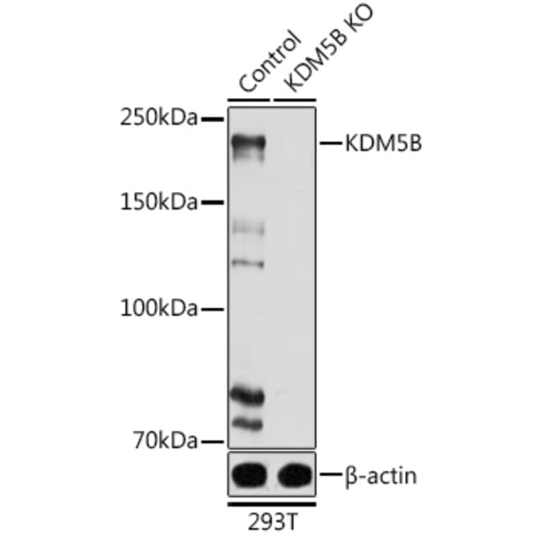 Western Blot - Anti-KDM5B/PLU1/Jarid1B Antibody (A10219) - Antibodies.com