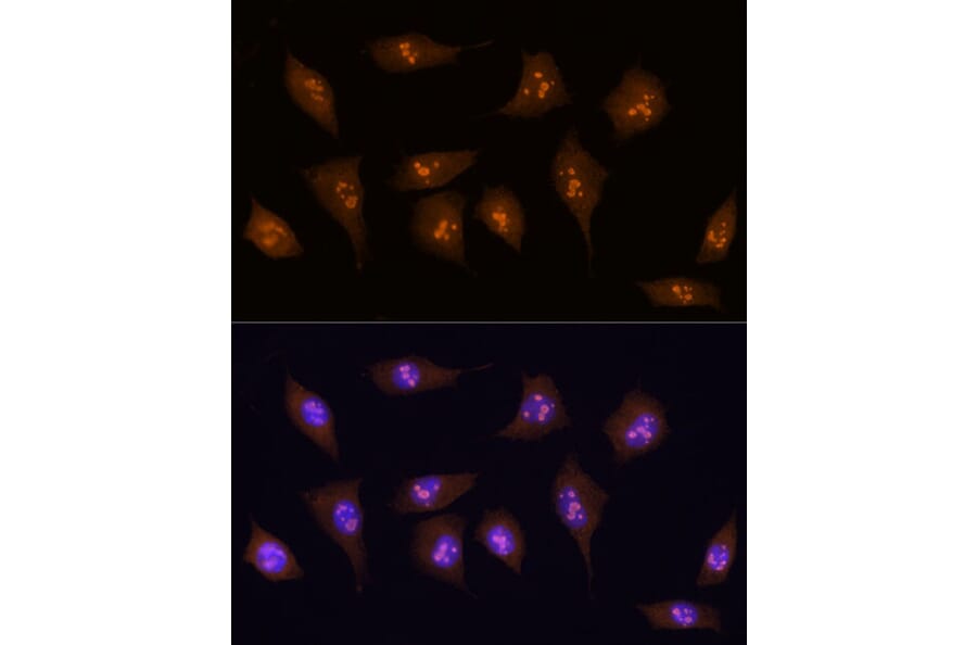 Immunofluorescence - Anti-KDM5B/PLU1/Jarid1B Antibody (A10219) - Antibodies.com