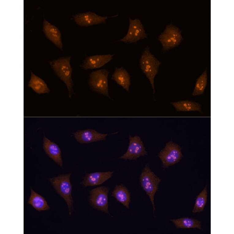 Immunofluorescence - Anti-KDM5B/PLU1/Jarid1B Antibody (A10219) - Antibodies.com