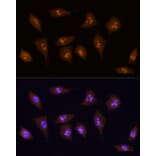 Immunofluorescence - Anti-KDM5B/PLU1/Jarid1B Antibody (A10219) - Antibodies.com