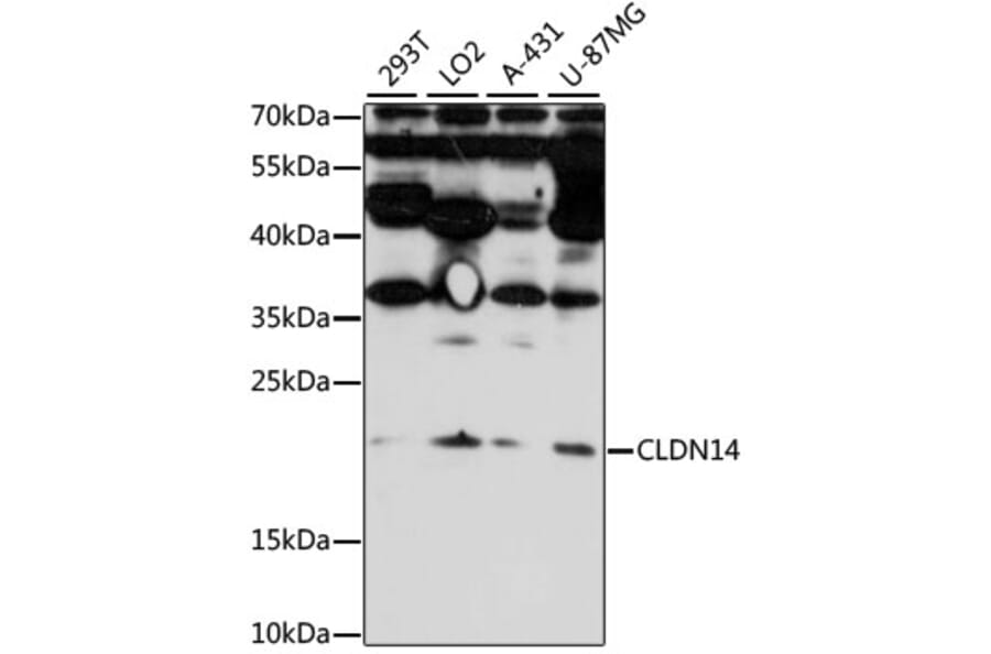 Western Blot - Anti-CLDN14 Antibody (A7787) - Antibodies.com