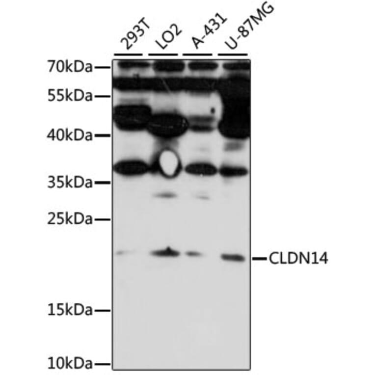 Western Blot - Anti-CLDN14 Antibody (A7787) - Antibodies.com