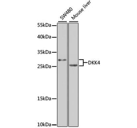 Western Blot - Anti-DKK4 Antibody (A7797) - Antibodies.com