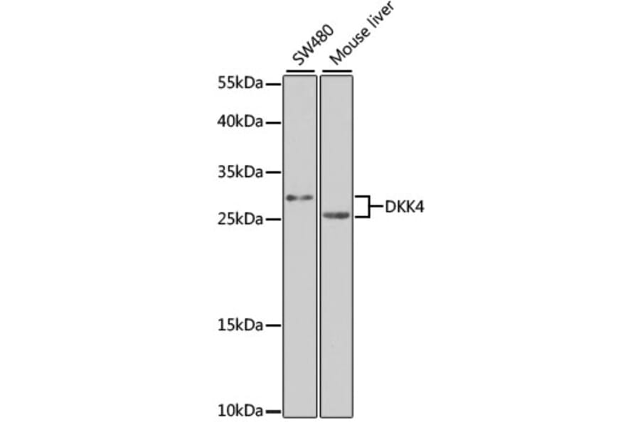 Western Blot - Anti-DKK4 Antibody (A7797) - Antibodies.com
