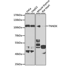 Western Blot - Anti-TNNI3K Antibody (A10225) - Antibodies.com