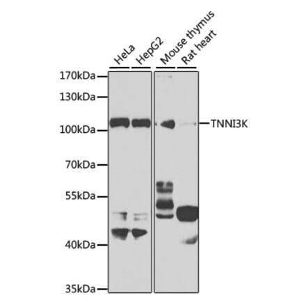 Western Blot - Anti-TNNI3K Antibody (A10225) - Antibodies.com