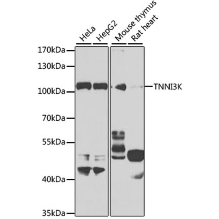 Western Blot - Anti-TNNI3K Antibody (A10225) - Antibodies.com