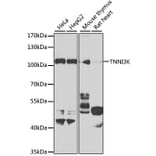 Western Blot - Anti-TNNI3K Antibody (A10225) - Antibodies.com