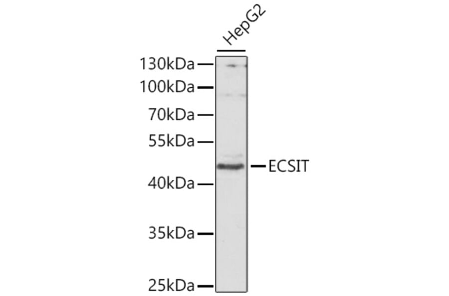 Western Blot - Anti-ECSIT Antibody (A10226) - Antibodies.com