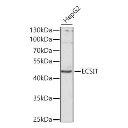 Western Blot - Anti-ECSIT Antibody (A10226) - Antibodies.com