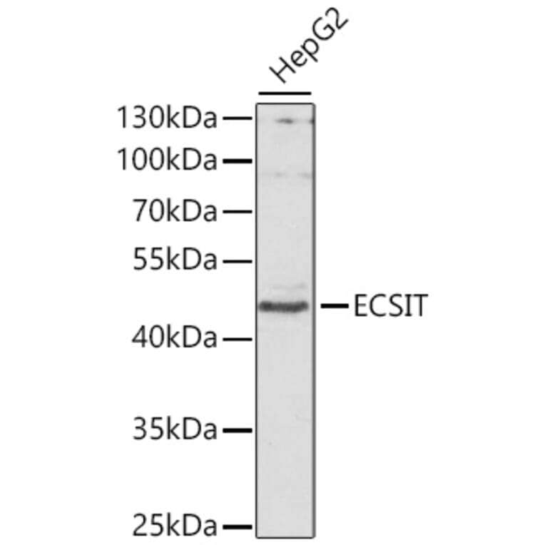Western Blot - Anti-ECSIT Antibody (A10226) - Antibodies.com