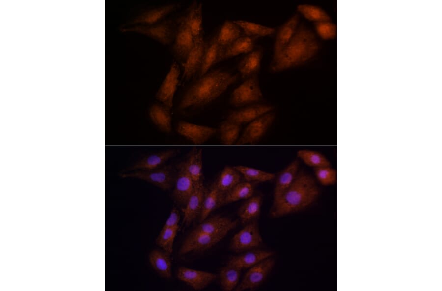 Immunofluorescence - Anti-ECSIT Antibody (A10226) - Antibodies.com