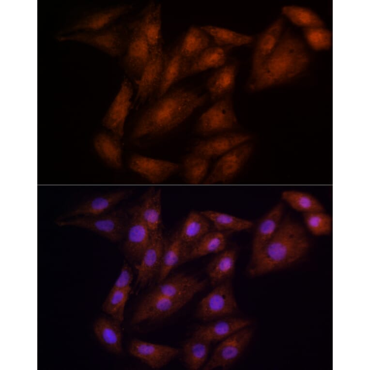 Immunofluorescence - Anti-ECSIT Antibody (A10226) - Antibodies.com