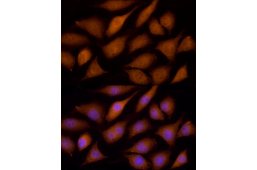 Immunofluorescence - Anti-ECSIT Antibody (A10226) - Antibodies.com