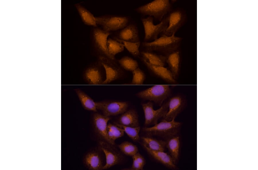 Immunofluorescence - Anti-ECSIT Antibody (A10226) - Antibodies.com