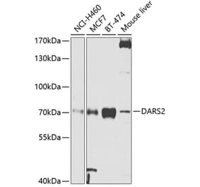 Western Blot - Anti-DARS2 Antibody (A10227) - Antibodies.com