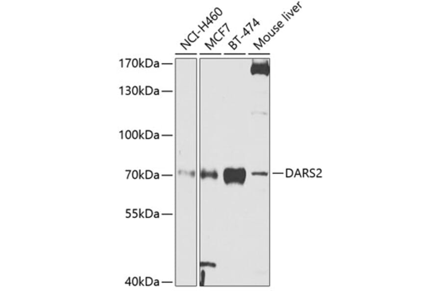 Western Blot - Anti-DARS2 Antibody (A10227) - Antibodies.com
