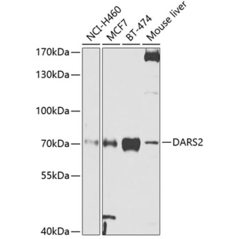Western Blot - Anti-DARS2 Antibody (A10227) - Antibodies.com
