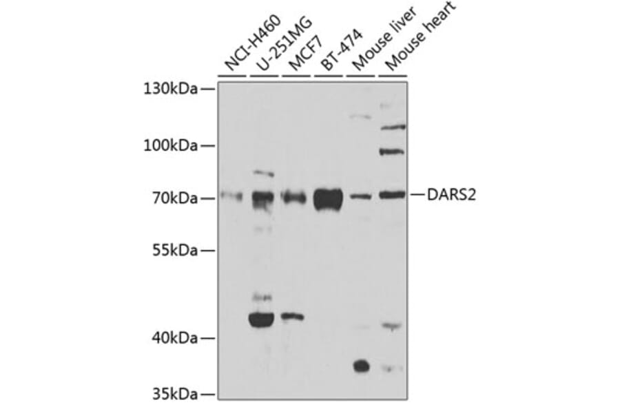 Western Blot - Anti-DARS2 Antibody (A10227) - Antibodies.com