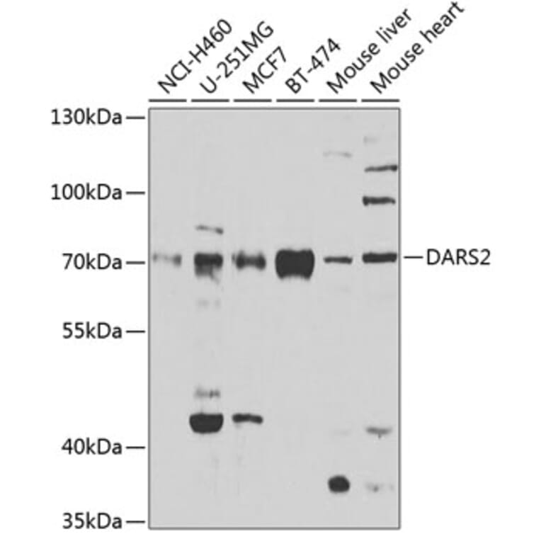 Western Blot - Anti-DARS2 Antibody (A10227) - Antibodies.com
