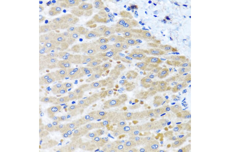 Immunohistochemistry - Anti-DARS2 Antibody (A10227) - Antibodies.com