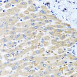 Immunohistochemistry - Anti-DARS2 Antibody (A10227) - Antibodies.com