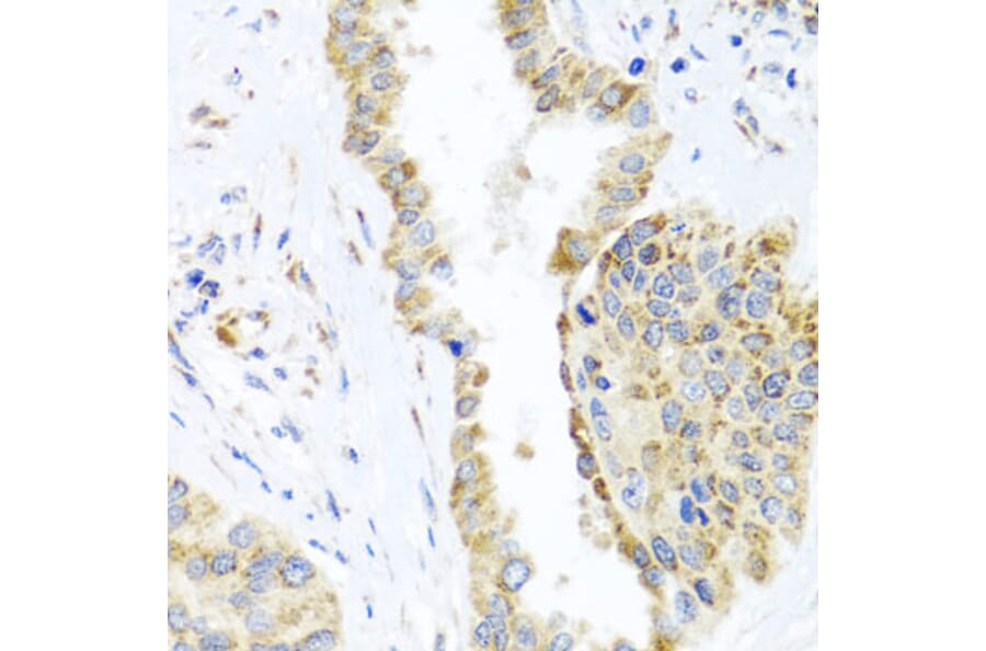 Immunohistochemistry - Anti-DARS2 Antibody (A10227) - Antibodies.com