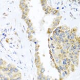 Immunohistochemistry - Anti-DARS2 Antibody (A10227) - Antibodies.com
