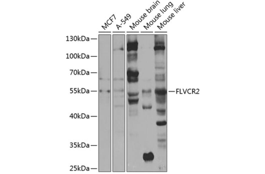 Western Blot - Anti-FLVCR2 Antibody (A10228) - Antibodies.com
