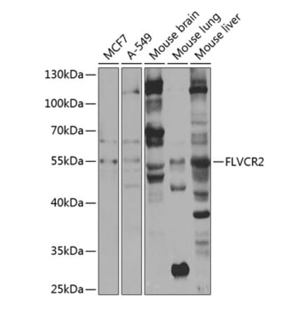 Western Blot - Anti-FLVCR2 Antibody (A10228) - Antibodies.com