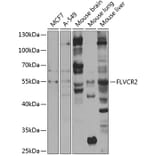 Western Blot - Anti-FLVCR2 Antibody (A10228) - Antibodies.com
