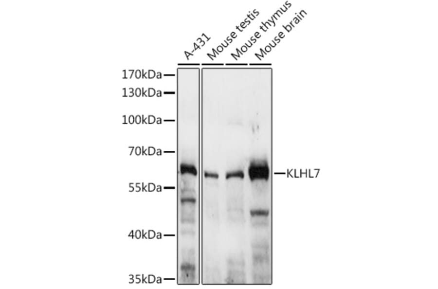 Western Blot - Anti-KLHL7 Antibody (A10229) - Antibodies.com