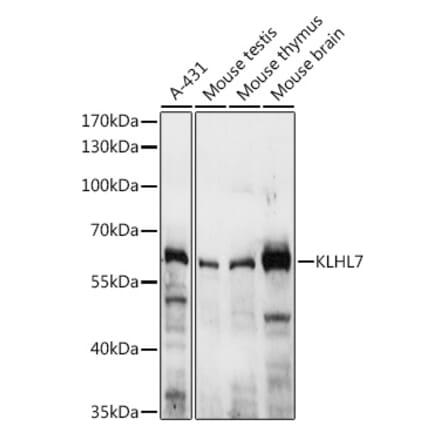 Western Blot - Anti-KLHL7 Antibody (A10229) - Antibodies.com