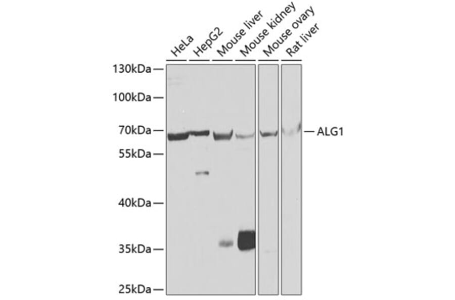 Western Blot - Anti-ALG1 Antibody (A10230) - Antibodies.com