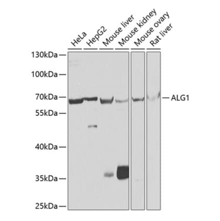 Western Blot - Anti-ALG1 Antibody (A10230) - Antibodies.com