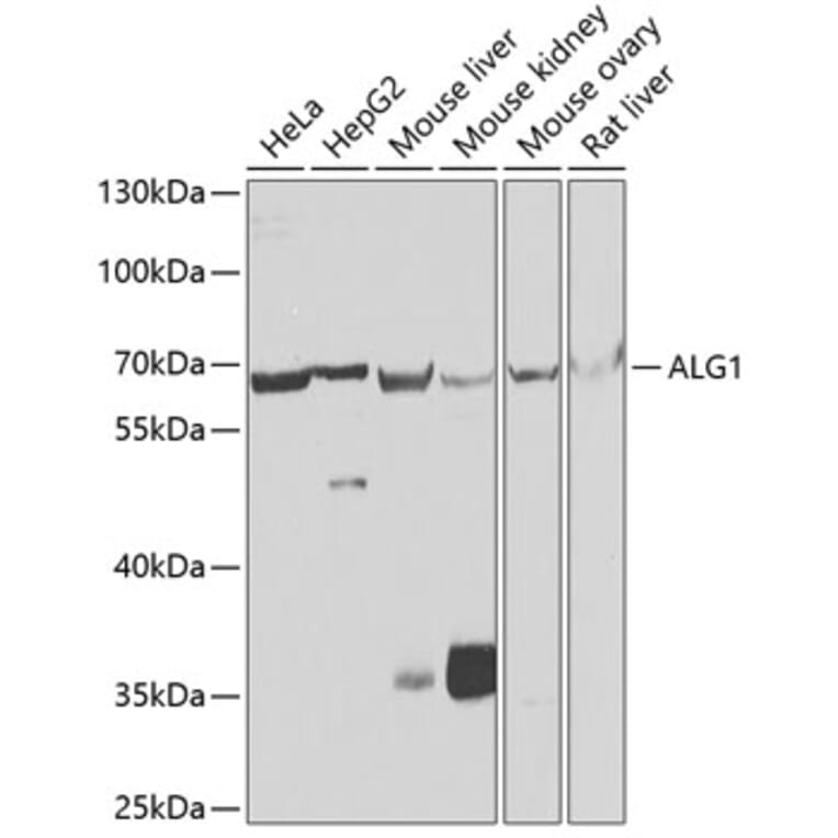 Western Blot - Anti-ALG1 Antibody (A10230) - Antibodies.com