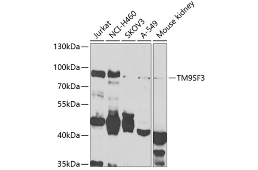 Western Blot - Anti-TM9SF3 Antibody (A7819) - Antibodies.com