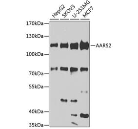 Western Blot - Anti-AARS2 Antibody (A10232) - Antibodies.com
