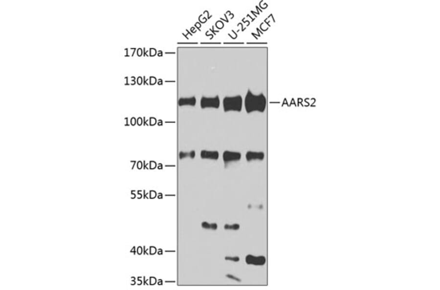 Western Blot - Anti-AARS2 Antibody (A10232) - Antibodies.com