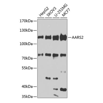 Western Blot - Anti-AARS2 Antibody (A10232) - Antibodies.com