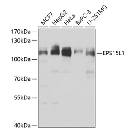 Western Blot - Anti-EPS15R Antibody (A10233) - Antibodies.com