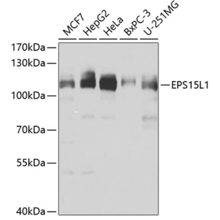 Western Blot - Anti-EPS15R Antibody (A10233) - Antibodies.com