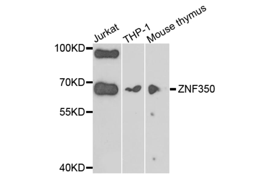 Western Blot - Anti-ZNF350 Antibody (A7829) - Antibodies.com
