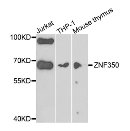 Western Blot - Anti-ZNF350 Antibody (A7829) - Antibodies.com