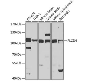 Western Blot - Anti-PLCD4 Antibody (A10236) - Antibodies.com