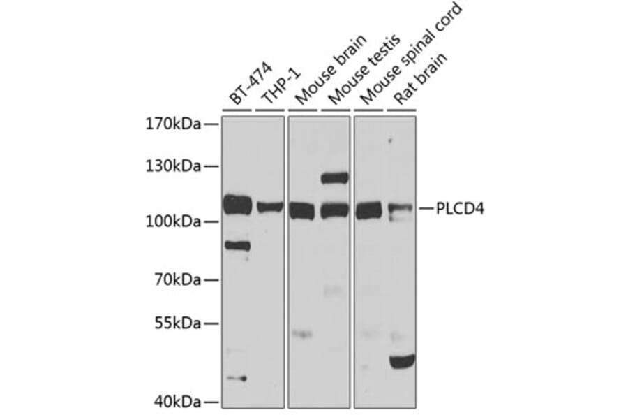 Western Blot - Anti-PLCD4 Antibody (A10236) - Antibodies.com