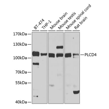 Western Blot - Anti-PLCD4 Antibody (A10236) - Antibodies.com