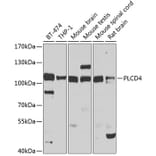 Western Blot - Anti-PLCD4 Antibody (A10236) - Antibodies.com