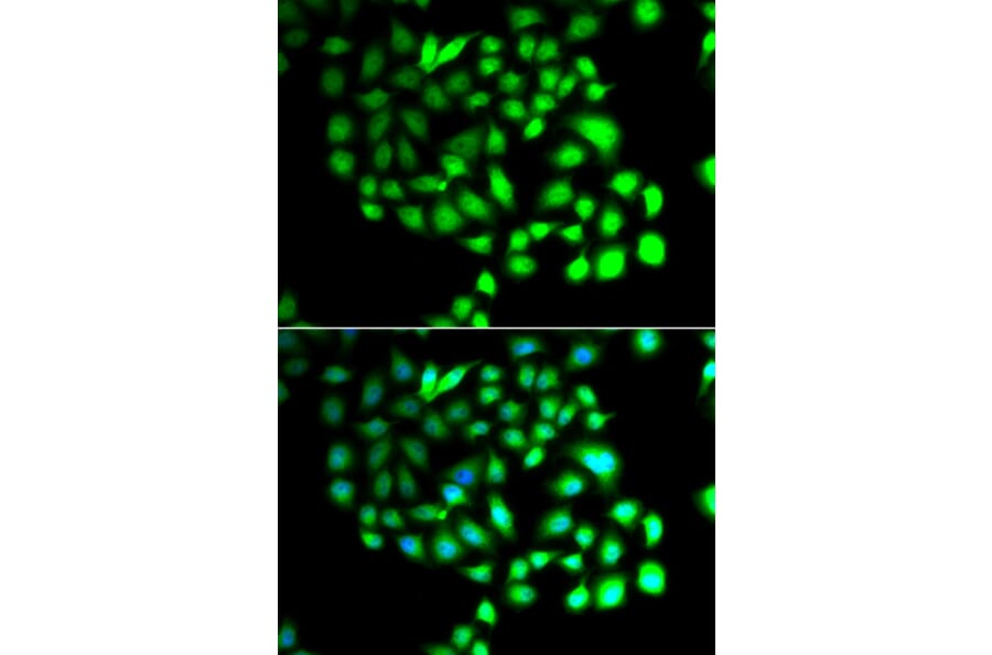 Immunofluorescence - Anti-TCEAL8 Antibody (A7845) - Antibodies.com